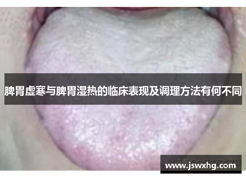 脾胃虚寒与脾胃湿热的临床表现及调理方法有何不同 脾胃虚寒与脾胃湿热的临床表现及调理方法有何不同